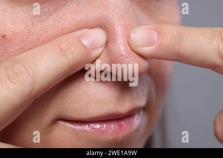 Femme popping bouton sur son nez sur fond gris, closeup Banque D'Images