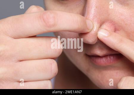 Femme popping bouton sur son nez sur fond gris, closeup Banque D'Images