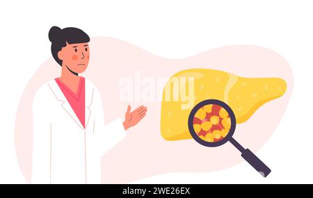 Foie gras malsain. Organe humain endommagé sous loupe. Concept de chercheur médical ou de médecin étudiant le tissu adipeux de foie. Illustration vectorielle Illustration de Vecteur