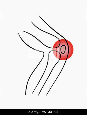 Illustration isolée vectorielle d'une douleur au genou. Tracé des contours d'une jambe humaine avec douleur dans les articulations. Illustration de Vecteur