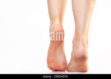 Vue arrière des jambes féminines avec talons de peau écailleuse. Espace de copie. Fond blanc. Soins cutanés et pédicure. Banque D'Images