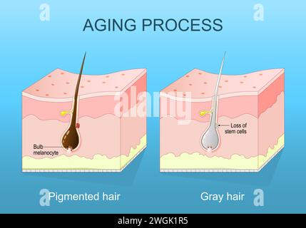 procédé de vieillissement. Cheveux grisonnés. Déplétion en mélanine et sénescence folliculaire pileuse. Coupe transversale d'une peau humaine. illustration vectorielle plate isométrique Illustration de Vecteur
