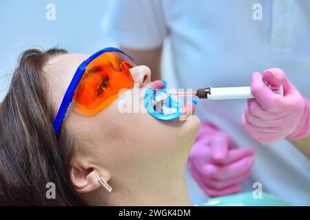 Dentiste en gants roses applique un gel blanchissant sur les dents du patient en clinique dentaire. Le blanchiment des dents en clinique dentaire. Gros plan Banque D'Images