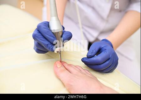 la podologue est une femme utilisant un laser pour traiter l'onychomycose - une maladie fongique des ongles. Cosmétologie matérielle Banque D'Images