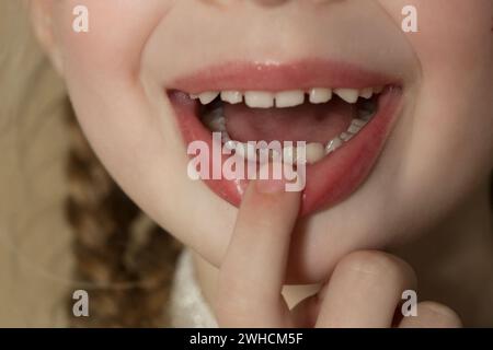 Fille préscolaire mignonne montrant une dent primaire (bébé) lâche Banque D'Images