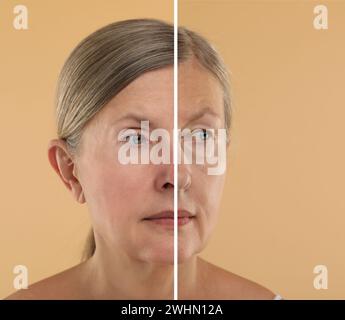 Modifications cutanées vieillissantes. Femme montrant le visage avant et après le rajeunissement, gros plan. Collage comparant l'état de la peau Banque D'Images