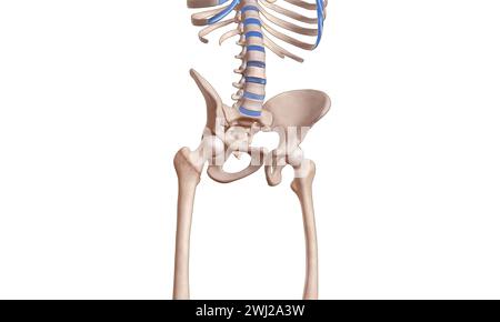 Fracture intertrochantérienne du squelette de la tête fémorale illustration médicale 3D. Banque D'Images