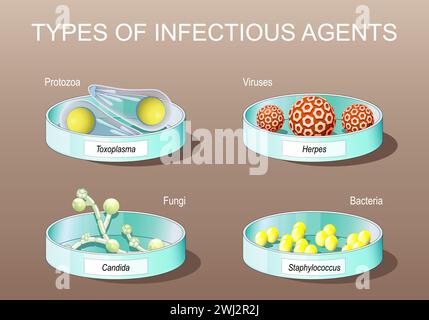 Types d'agents infectieux. pathogènes. Protozoaire parasitaire. Virus, bactéries, champignons et organismes unicellulaires. Boîtes de Pétri avec Candida albicans, elle Illustration de Vecteur