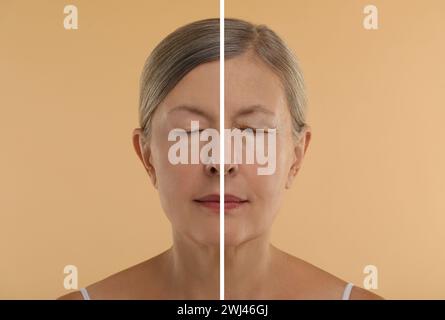 Modifications cutanées vieillissantes. Femme montrant le visage avant et après le rajeunissement, gros plan. Collage comparant l'état de la peau Banque D'Images