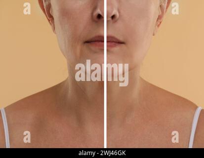 Modifications cutanées vieillissantes. Femme montrant le cou avant et après le rajeunissement, gros plan. Collage comparant l'état de la peau Banque D'Images