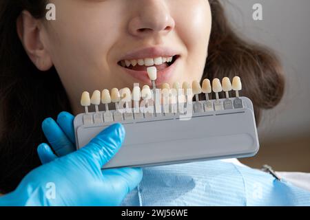 Dentiste choisissant le ton de couleur de l'émail des dents pour le patient. Dentiste appliquant l'échantillon à partir de la balance d'émail des dents Banque D'Images