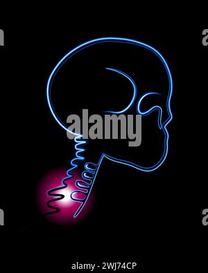 Illustration vectorielle isolée de douleurs des vertèbres cervicales. Tracé du contour de la région cervicale avec localisation de la douleur dans les vertèbres. Illustration de Vecteur