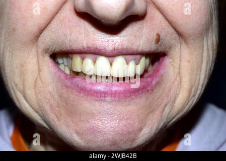 Dans la bouche ouverte de la femme, deux rangées de dents sont visibles. Photo de haute qualité Banque D'Images