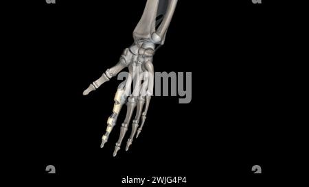 Le ligament annulaire est une structure complexe formée de la capsule, du complexe ligamentaire latéral collatéral et du muscle supinateur qui agissent à l'unisson Banque D'Images