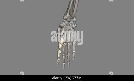 Le ligament annulaire est une structure complexe formée de la capsule, du complexe ligamentaire latéral collatéral et du muscle supinateur qui agissent à l'unisson Banque D'Images