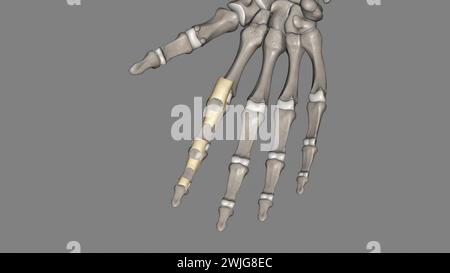 Le ligament annulaire est une structure complexe formée de la capsule, du complexe ligamentaire latéral collatéral et du muscle supinateur qui agissent à l'unisson Banque D'Images