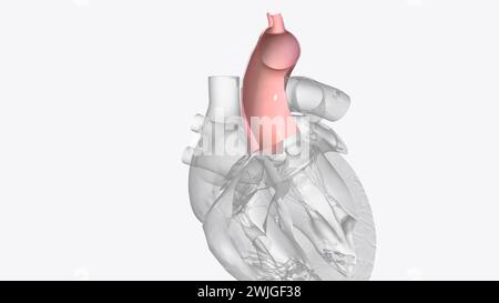 La valvule aortique est l'une des quatre valvules cardiaques et est la dernière rencontrée par le sang oxygéné lorsqu'il quitte le cœur illustration 3D. Banque D'Images