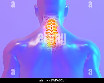 3D illustration, le cou douloureux skeleton x-ray, concept médical. Banque D'Images