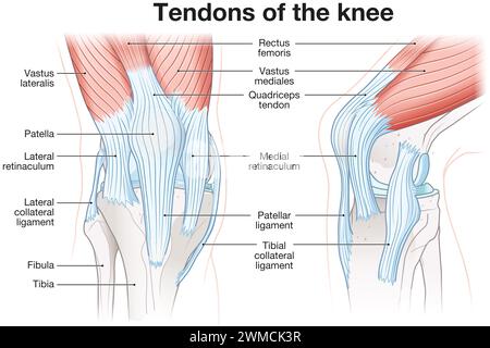 Les ligaments de l'articulation du genou comprennent le ligament croisé antérieur (LCA), le ligament croisé postérieur (LCP), les ligaments collatéraux médial et latéral. Banque D'Images