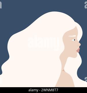 Beau portrait de femme albinos. Profil d'une jeune femme atteinte d'albinisme. Génétique rare aspect. Illustration vectorielle Illustration de Vecteur