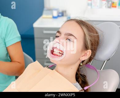 Conception des soins dentaires. Image agrandie de bagues en céramique et en métal sur les dents. Vue rapprochée des mains du dentiste appliquant de la colle bleue sur le bo propre du patient Banque D'Images