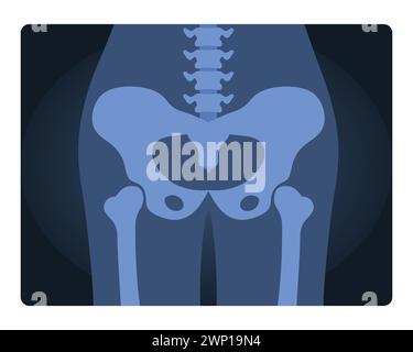 Cliché radiographique du bassin humain. Test médical du squelette, illustration vectorielle de dessin animé de radiographie corporelle Illustration de Vecteur