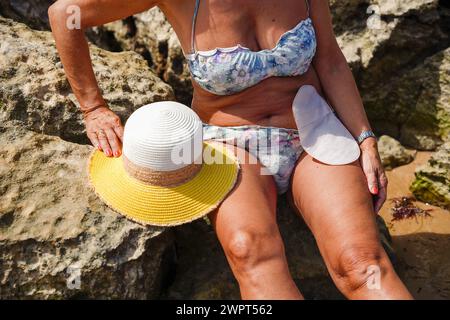 Femme méconnaissable sur les rochers de la plage montrant le sac de stomie. journée mondiale contre le cancer Banque D'Images
