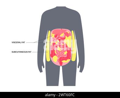 Schéma de la graisse viscérale, illustration. La graisse du ventre entoure les organes internes dans la cavité abdominale. Banque D'Images