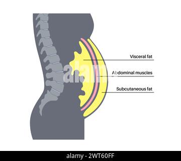 Schéma de la graisse viscérale, illustration. La graisse du ventre entoure les organes internes dans la cavité abdominale. Banque D'Images