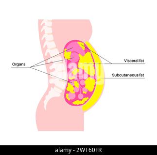 Schéma de la graisse viscérale, illustration. La graisse du ventre entoure les organes internes dans la cavité abdominale. Banque D'Images