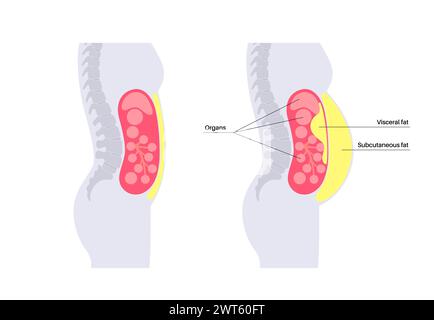 Schéma de la graisse viscérale, illustration. La graisse du ventre entoure les organes internes dans la cavité abdominale. Banque D'Images