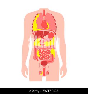 Schéma de la graisse viscérale, illustration. La graisse du ventre entoure les organes internes dans la cavité abdominale. Banque D'Images