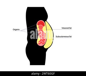 Schéma de la graisse viscérale, illustration. La graisse du ventre entoure les organes internes dans la cavité abdominale. Banque D'Images