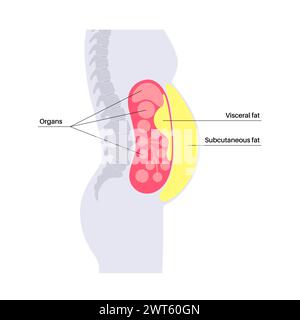 Schéma de la graisse viscérale, illustration. La graisse du ventre entoure les organes internes dans la cavité abdominale. Banque D'Images