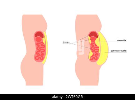 Schéma de la graisse viscérale, illustration. La graisse du ventre entoure les organes internes dans la cavité abdominale. Banque D'Images