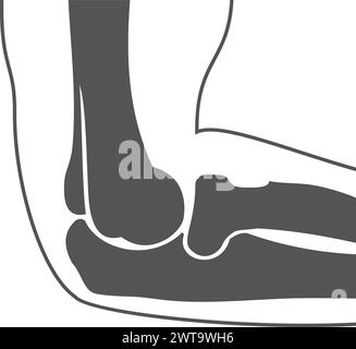 OS de l'articulation du coude. Illustration noire de l'anatomie de la main Illustration de Vecteur