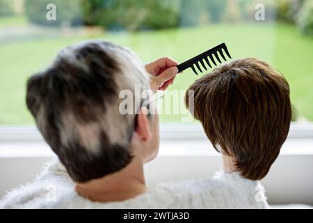 Femme avec alopécie peignant une perruque Banque D'Images