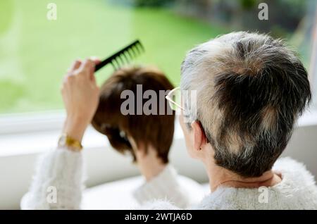 Femme avec alopécie peignant une perruque Banque D'Images