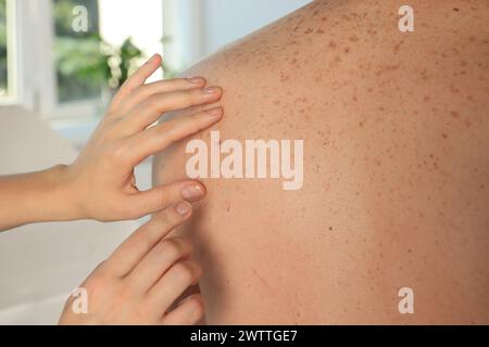 Dermatologue examinant la marque de naissance du patient à l'intérieur, vue rapprochée Banque D'Images