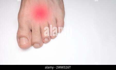 Gros plan du cou-de-pied d'une personne gauche avec une marque rouge représentant la douleur Banque D'Images