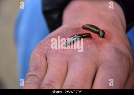 Srinagar, Inde. 21 mars 2024. Un patient reçoit une thérapie de sangsue sur sa main à Srinagar.chaque année, les travailleurs de la santé traditionnels dans la vallée du Cachemire utilisent des sangsues pour traiter les gens pour les petites, démangeaisons, des masses douloureuses qui se développent sur la peau appelées engelures, acquises pendant l'hiver sur Nowruz, qui marque le premier jour du printemps et le début de l'année dans le calendrier persan. (Photo de Saqib Majeed/SOPA images/Sipa USA) crédit : Sipa USA/Alamy Live News Banque D'Images