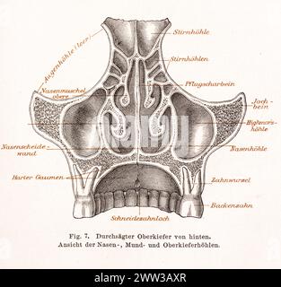 Médecine, anatomie, illustration, dessin, représentation détaillée de la mâchoire supérieure sciée et des cavités nasales, de la cavité buccale et maxillaire Banque D'Images