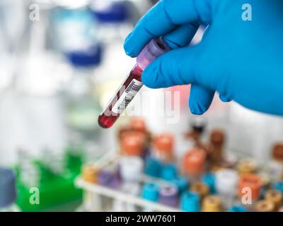 Tests médicaux, échantillons de sang en cours de préparation pour l'analyse. Banque D'Images