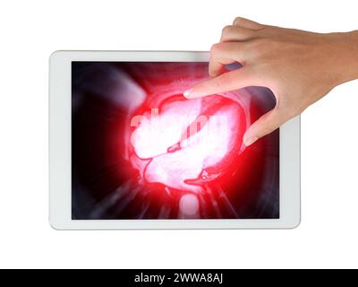 Les images IRM cardiaques sur tablette sont essentielles à l'évaluation de la santé cardiaque, à l'identification des anomalies cardiaques isolées sur fond blanc Banque D'Images