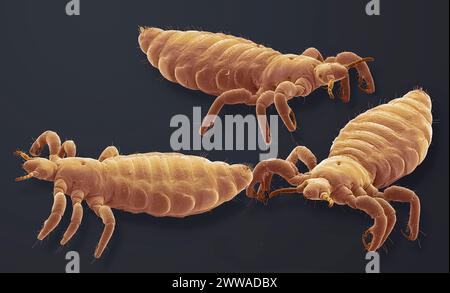 Poux de tête. Micrographie électronique à balayage coloré (MEB) de poux de tête (Pediculus humanus capitis). Grossissement : x10 lors de l'impression de 10 centimètres de large. Banque D'Images