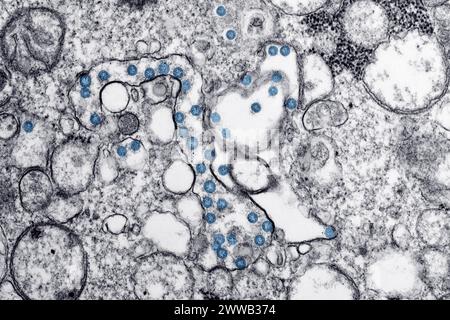 Image au microscope électronique à transmission d’un isolat du premier cas américain de COVID-19, anciennement connu sous le nom de 2019-nCoV. Banque D'Images