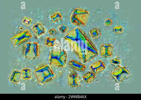 Oxalates de calcium (cristal ionique qui intervient dans près de 80% de la composition des calculs rénaux). Microscopie optique. Banque D'Images