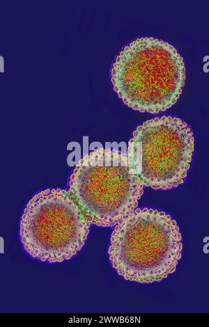 Virus grippal. Virus de la famille des Orthomyxoviridae. Virus de la peste aviaire. Banque D'Images