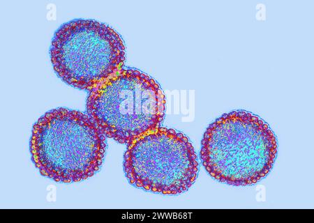 Virus grippal. Virus de la famille des Orthomyxoviridae. Virus de la peste aviaire. Banque D'Images