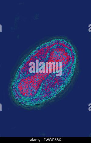 Virus de la variole (les poxvirus sont de gros virus de 300/200/100 nm. Banque D'Images